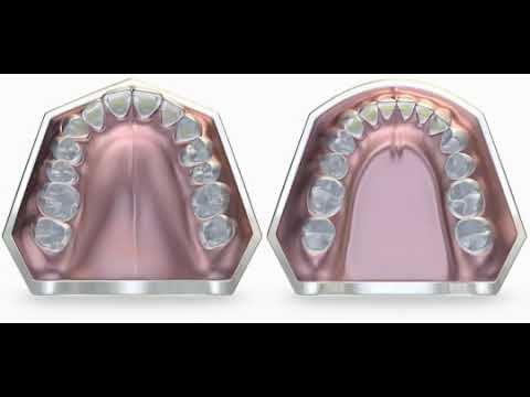 Высокое Готическое небо