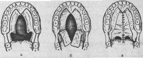 Строение речевого аппарата альвеолы