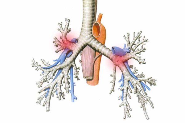 Острый облитерирующий бронхиолит