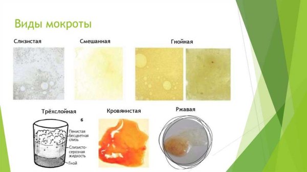 Капли крови на простыне