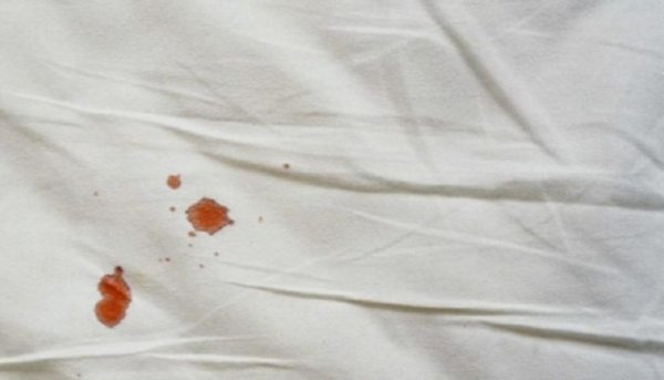 Лола кизгалдок