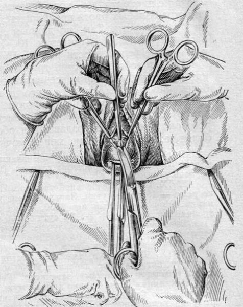 Цветы из пластиковых бутылок своими руками