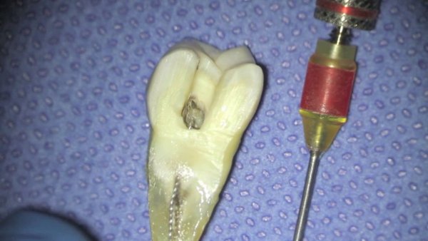 Что делать если укусиь Клед