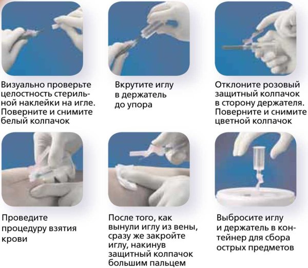 Эндодонтия в стоматологии