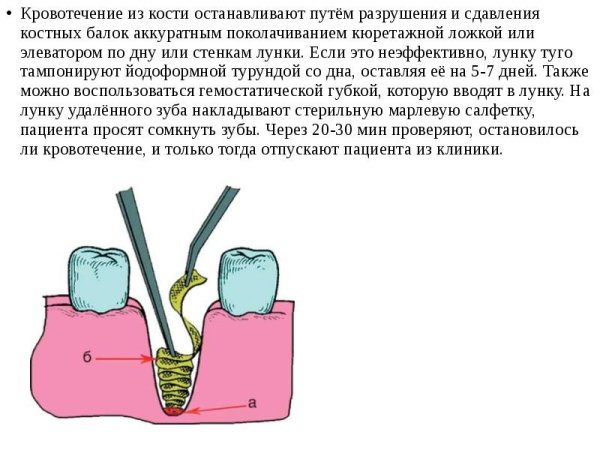 Как достать картинку из видео на ютубе