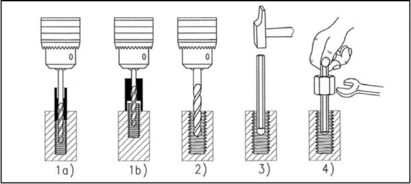 Порт система для внутривенного введения