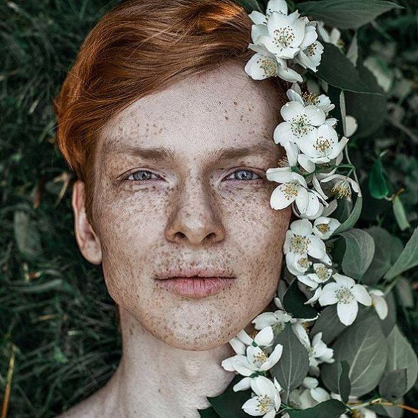 Веснушки у мужчин