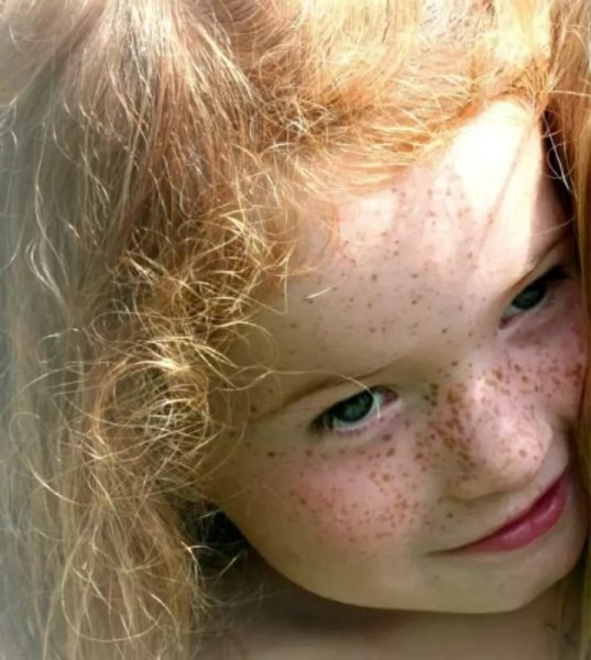 Дети с веснушками