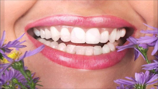 Красивые Здоровые зубы и Десна