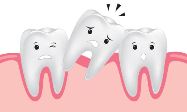 Зуб на голубом фоне