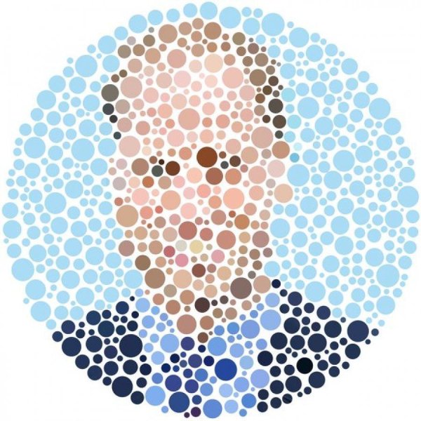 Дисхромия глаз дальтонизм