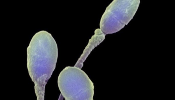 Красивое окончание на лицо