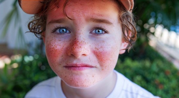 Солнцезащитный крем на пляже