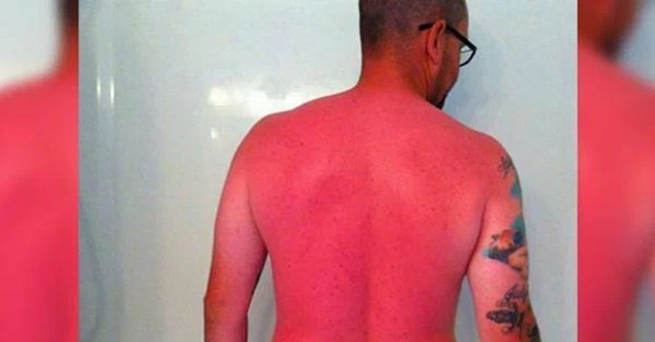 Жаркое солнце