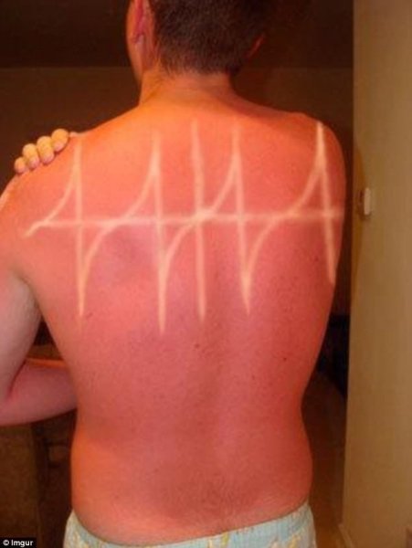 Сжигание жира