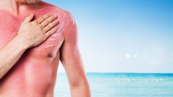 Горелая ткань