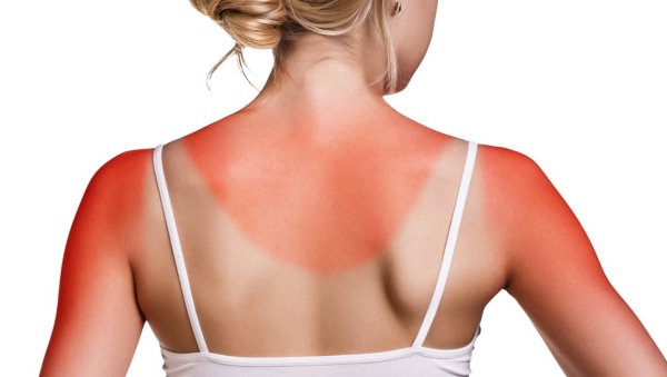 Девушка и огонь