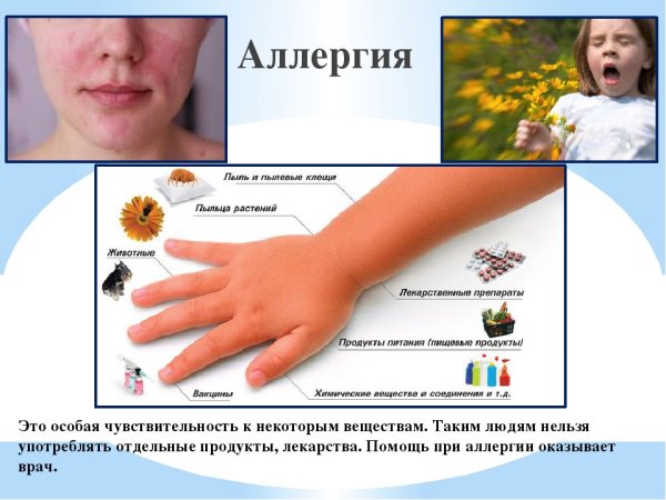 Аллергия у детей презентация