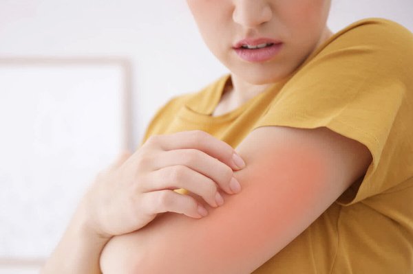 Аллергическая реакция