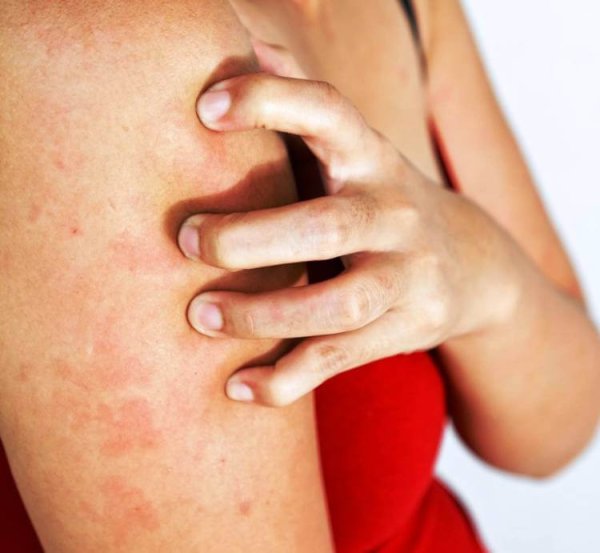 Солнечный загар