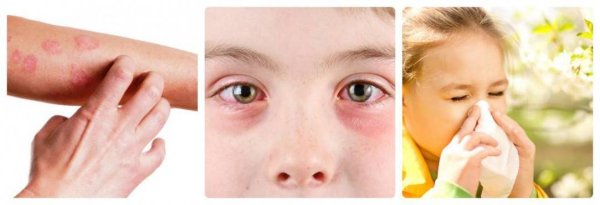 Раздраженная кожа лица