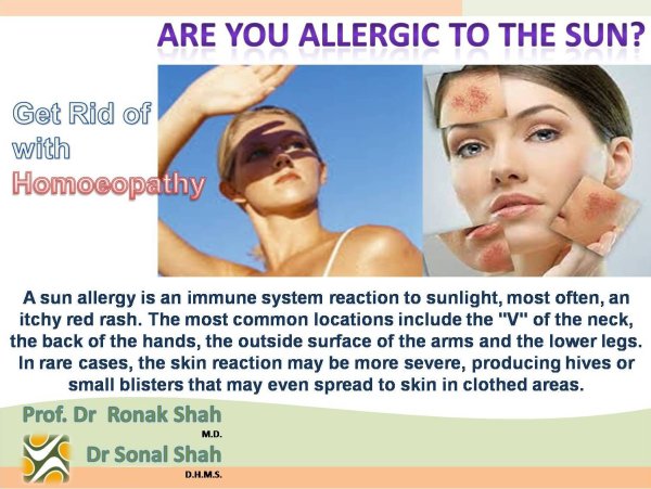 Фотосенсибилизация фотодерматит