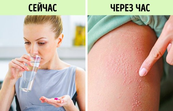 Чесотка псевдо саркоптоз