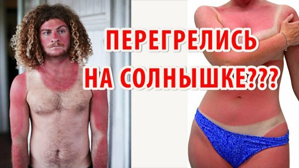 Загорела спина от солнца