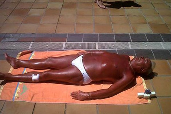 Обгорел на солнце прикол