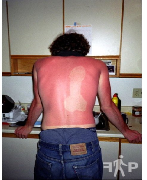 Обгорели на солнце Мем