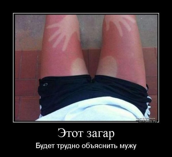 Сгорел на солнце смешные рисунки