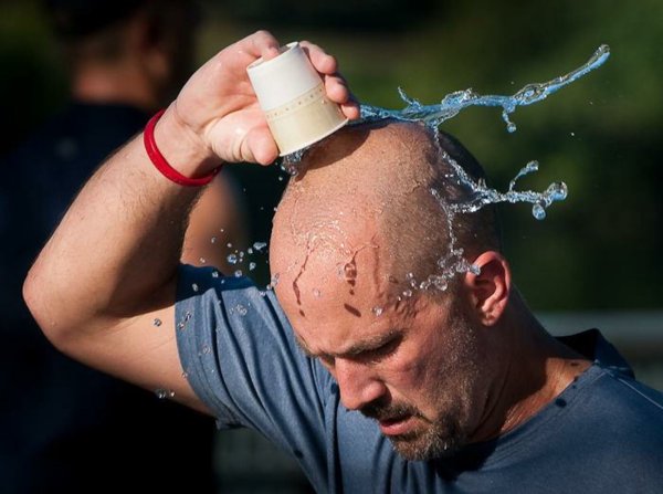 Солнечный удар у ребенка