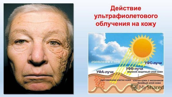 Польза загара