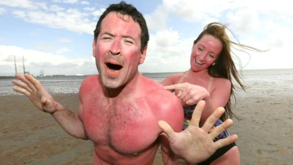 Полосатый загар