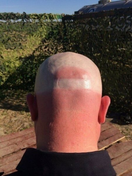 Демотиваторы про загар