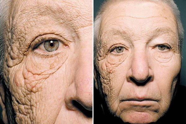 Солнце полезно для человека