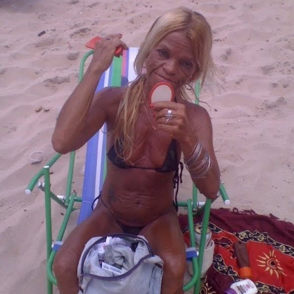 Шутки про обгоревших на солнце