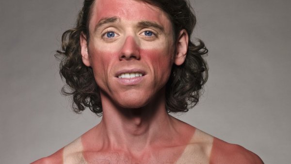 Смешной загар у девушек