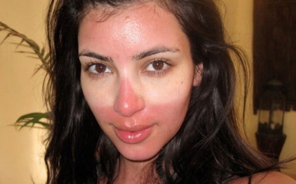 Приколы про обгоревших на солнце