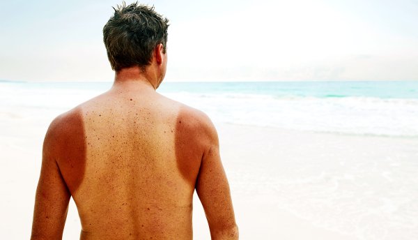 Гиф огонь вспыхнуло