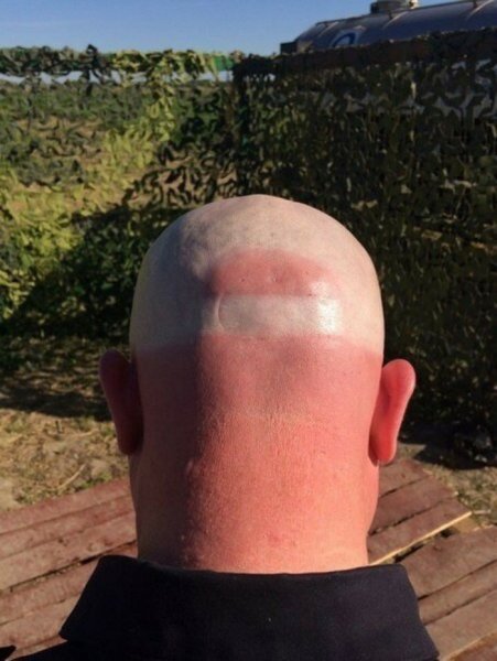 Летний загар