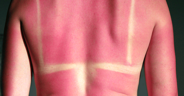 Очень жарко солнце