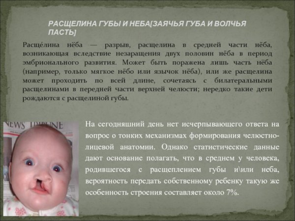 Косая расщелина лица колобома