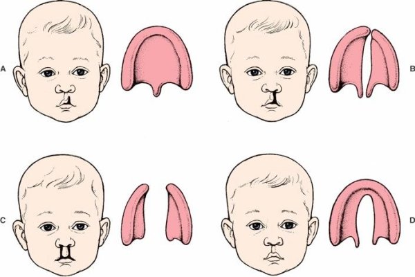 Расщелина неба Волчья пасть