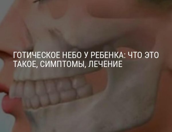 Готическое небо симптомы