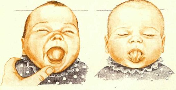 Анатомия твердого неба верхней челюсти