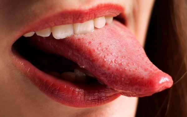 Воспаление слизистой оболочки ротовой полости