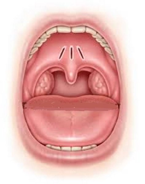 Сифилитическая пузырчатка