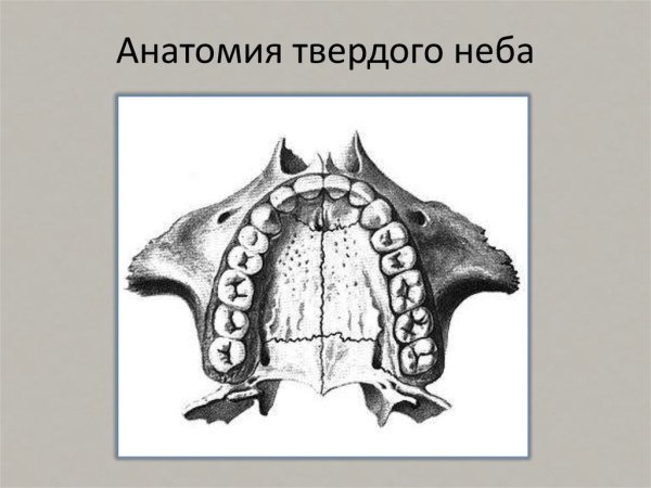 Седловидная форма верхней челюсти
