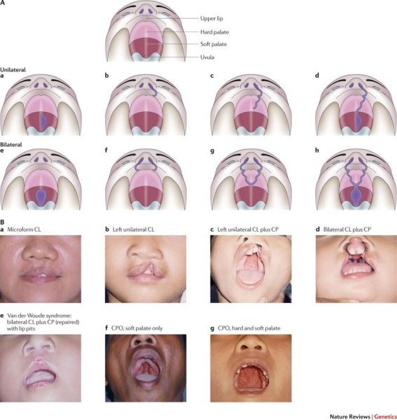 Твердое небо мягкое небо небная занавеска